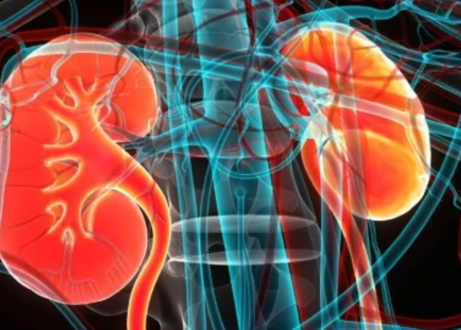 Kidney Problems